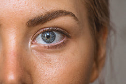 Inside out approach to acne